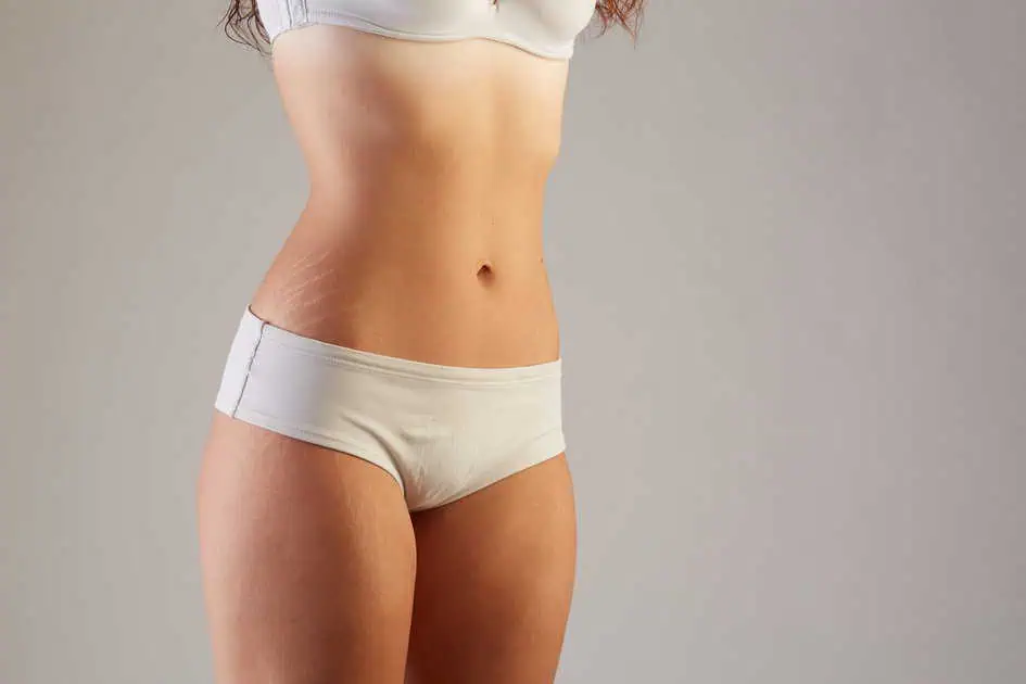 Treatments for Stretch Mark Removal by Dr. Amber Bocknek in Aurora, ON